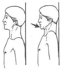 Image result for chin tuck exercise