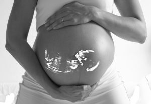 Pregnancy exercises