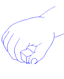 skier's thumb