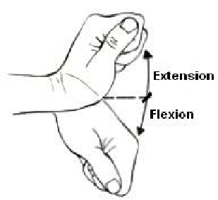 Medial epicondylitis