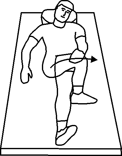 hip impingement syndrome