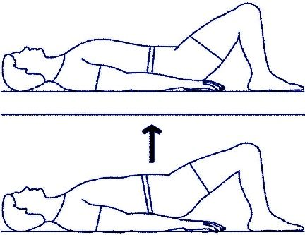 hip impingement syndrome