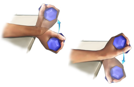 Medial epicondylitis